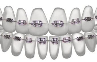 Kaip technologijos keičia ortodontijos pasaulį?