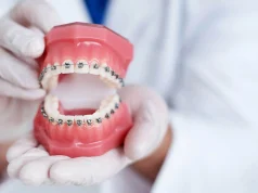 Kokias būdais galima ištiesinti kreivus dantis?