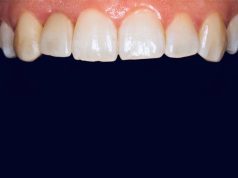 Holistinis dantų gydymas: kas tai ir kuo jis skiriasi nuo tradicinio?