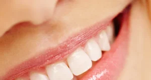 Estetinis plombavimas: kam tinka ir kaip pasirūpinti ilgalaikiu rezultatu