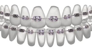 Kaip technologijos keičia ortodontijos pasaulį?