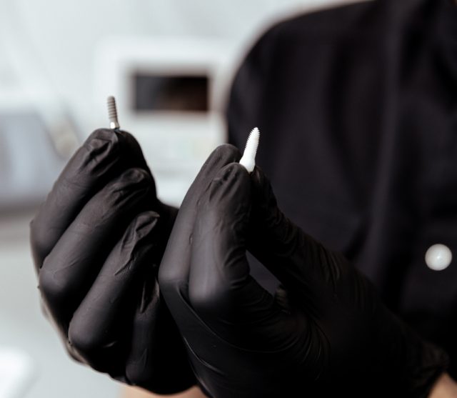 Cirkonio-ir-titano-dantu-implantai.-Kuo-jie-skiriasi