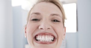 Nemokama burnos vėžio patikra visą vasario mėnesį